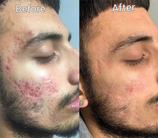 Shahzaib
