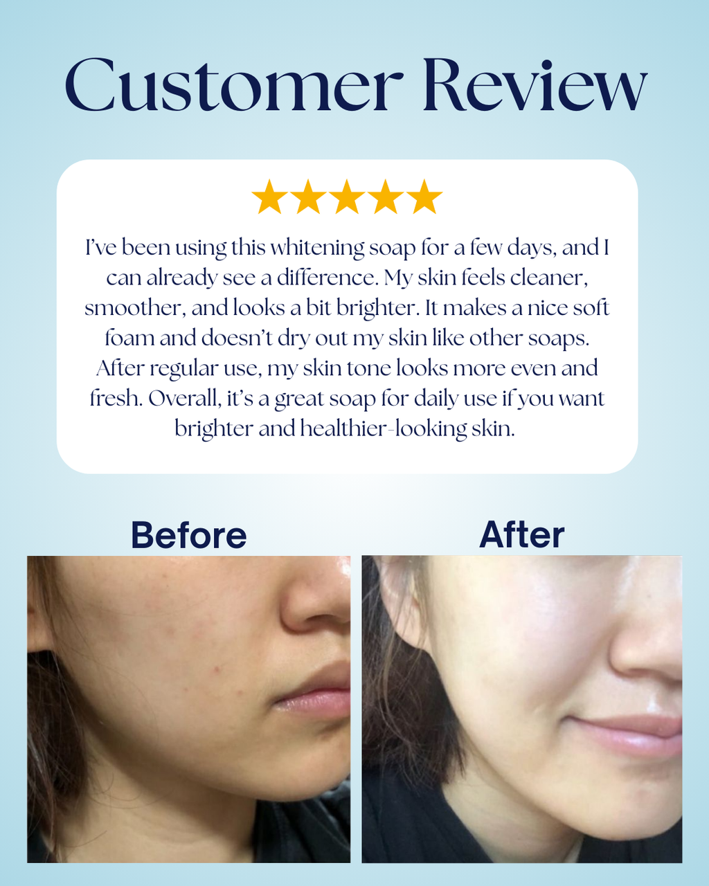 WhiteMax Whitening Soap – Glutathione & Niacinamide Formula | 7 Days Guaranteed Bright Skin