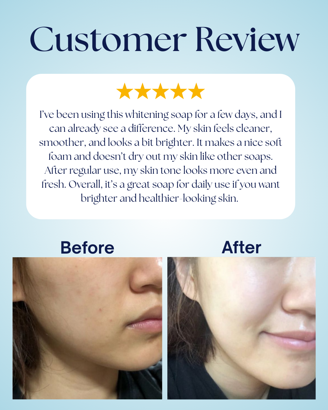 WhiteMax Whitening Soap – Glutathione & Niacinamide Formula | 7 Days Guaranteed Bright Skin