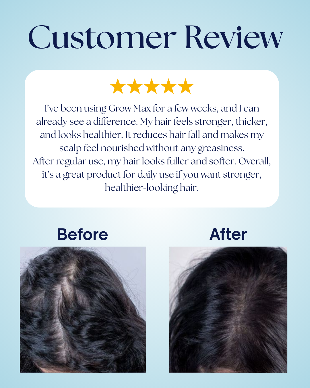 Max Grow - Hair Repair l Hair Growth Serum