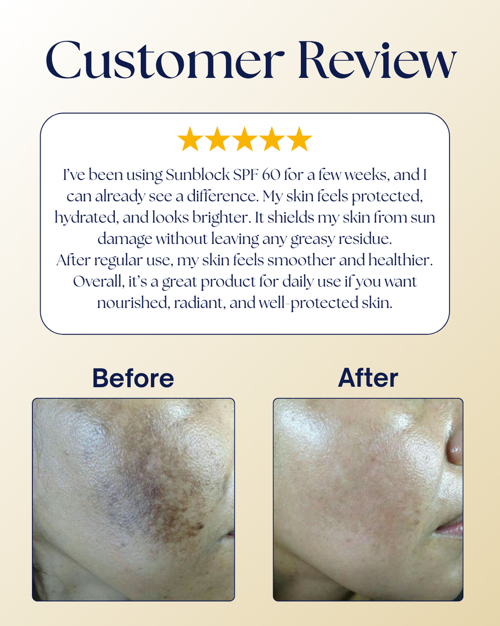 Sun-Max - Sunblock (SPF 50 PA+++) – Non-Greasy & No White Cast Formula