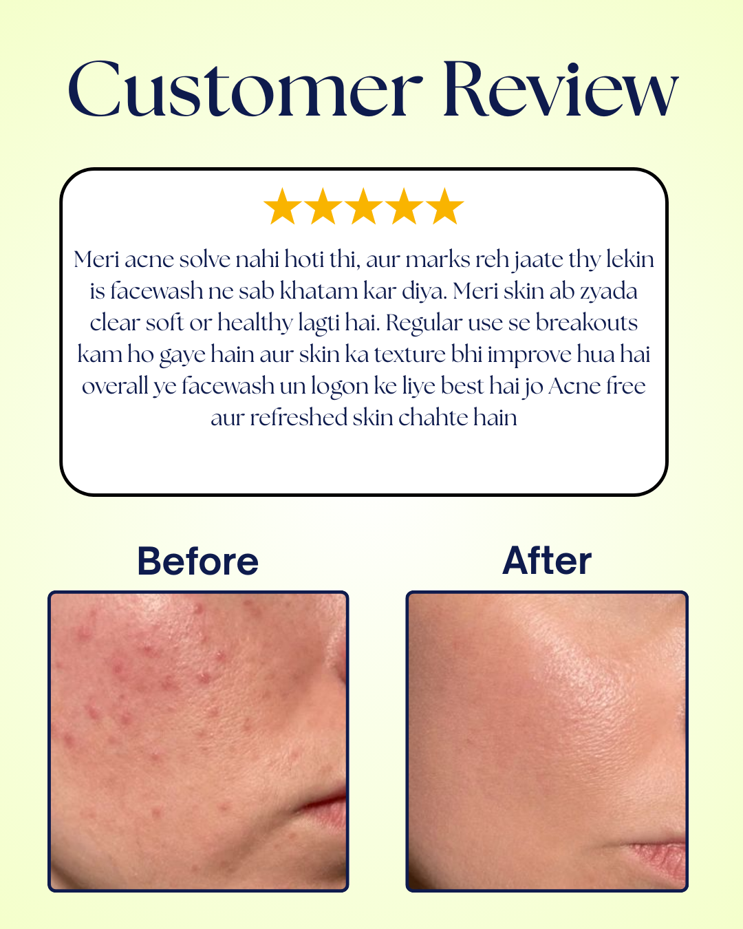 Max Beads - Anti Acne Face Wash