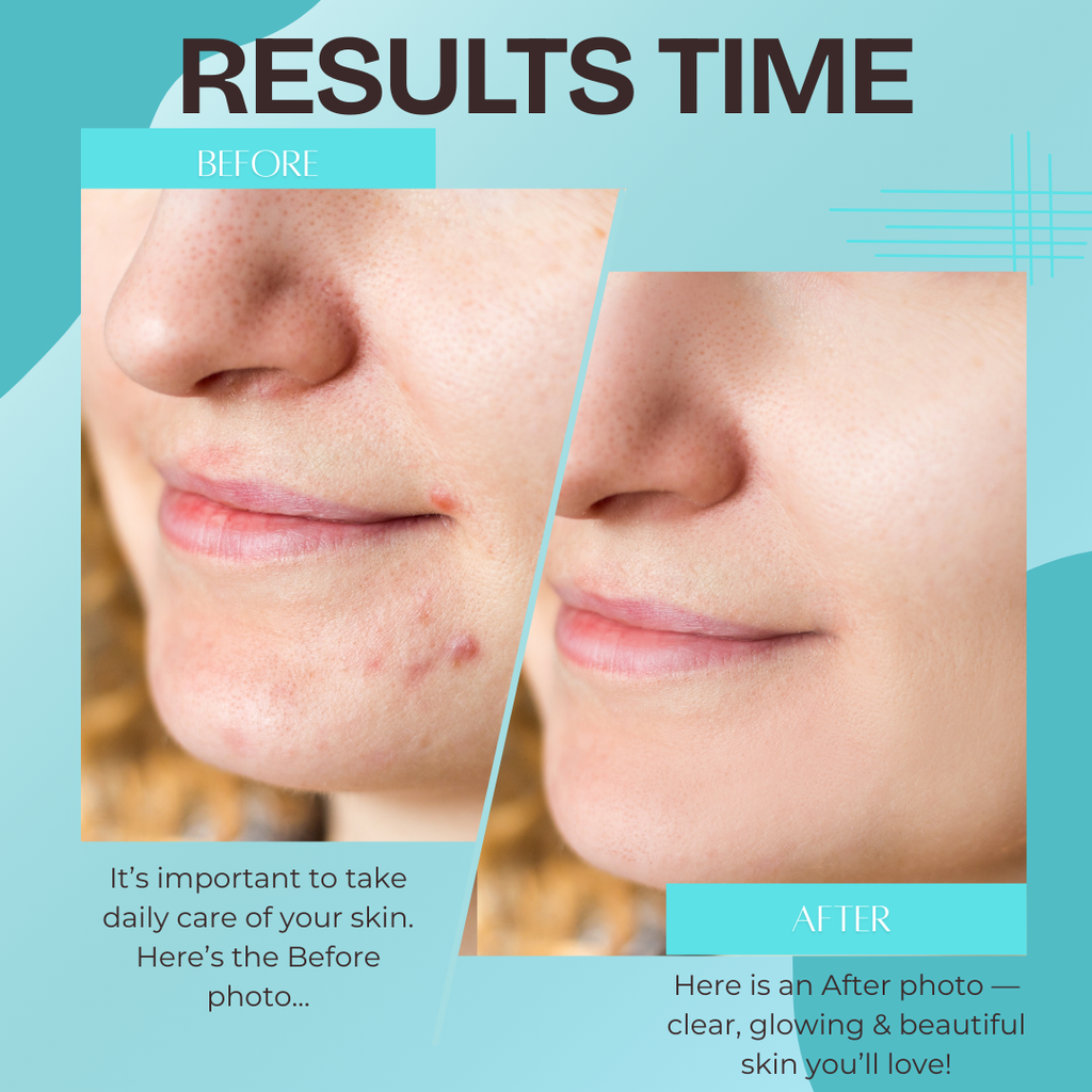 White Max Brightening Pack – Powered by Niacinamide, Glutathione & Vitamin C