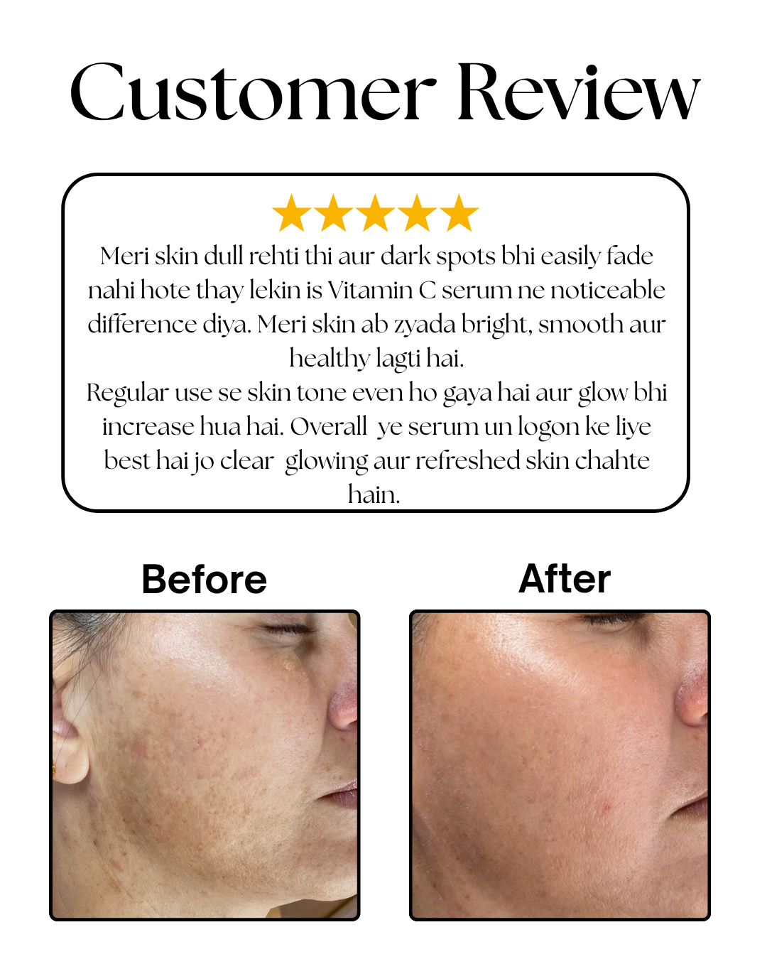 Vitamax-C Remove Dark Spots in 14 Days