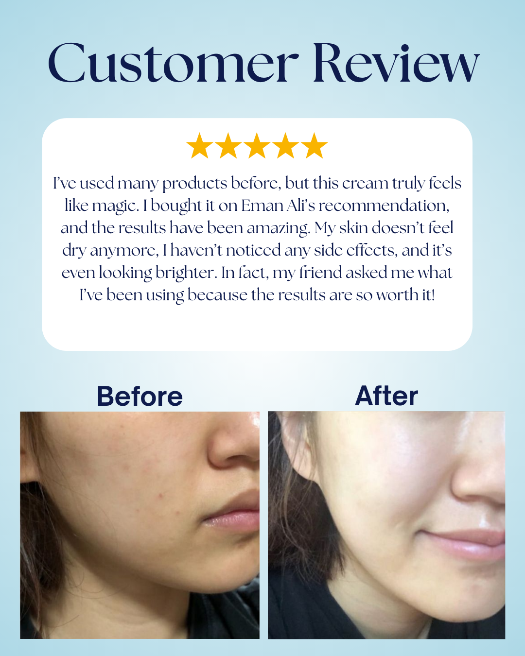 White Max - Whitening Cream