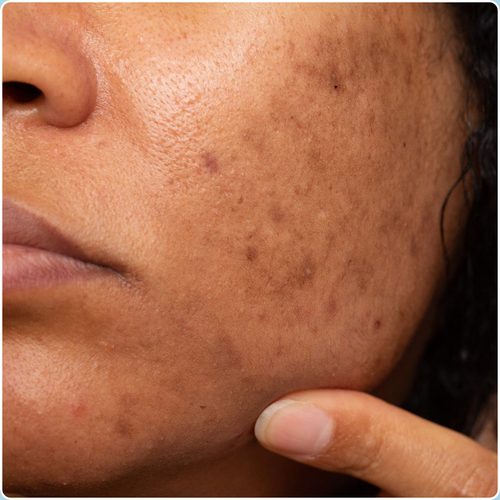 Sodium Ascorbyl Phosphate