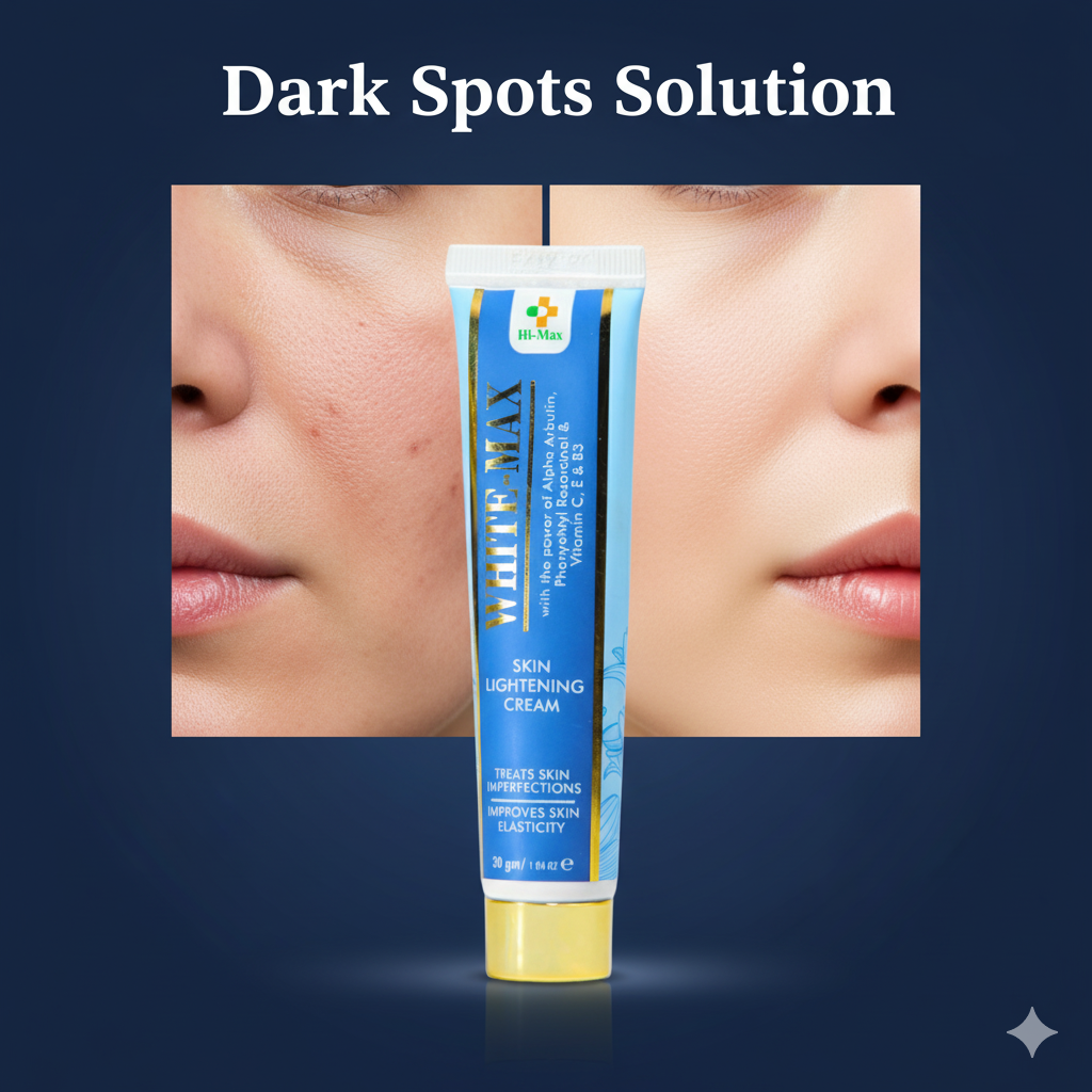 White Max - Whitening Cream + Free Whitening Soap