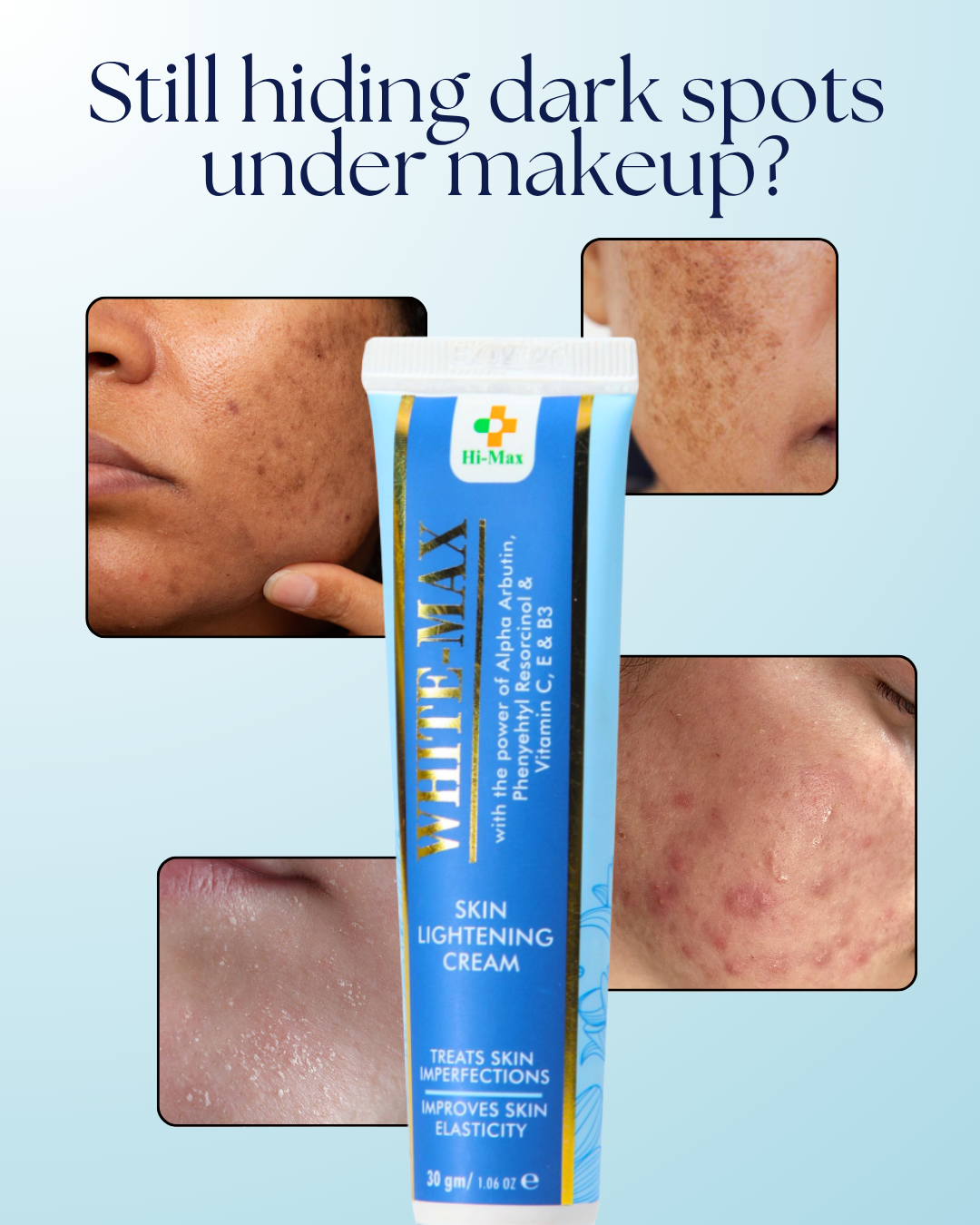 White Max - Whitening Cream