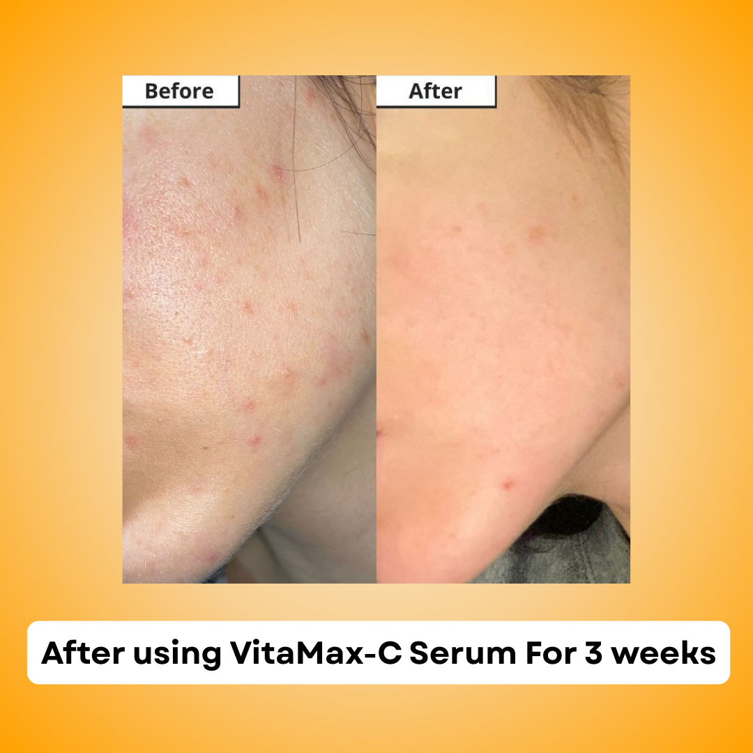 Vitamax-C Brightening & Anti-Aging Serum