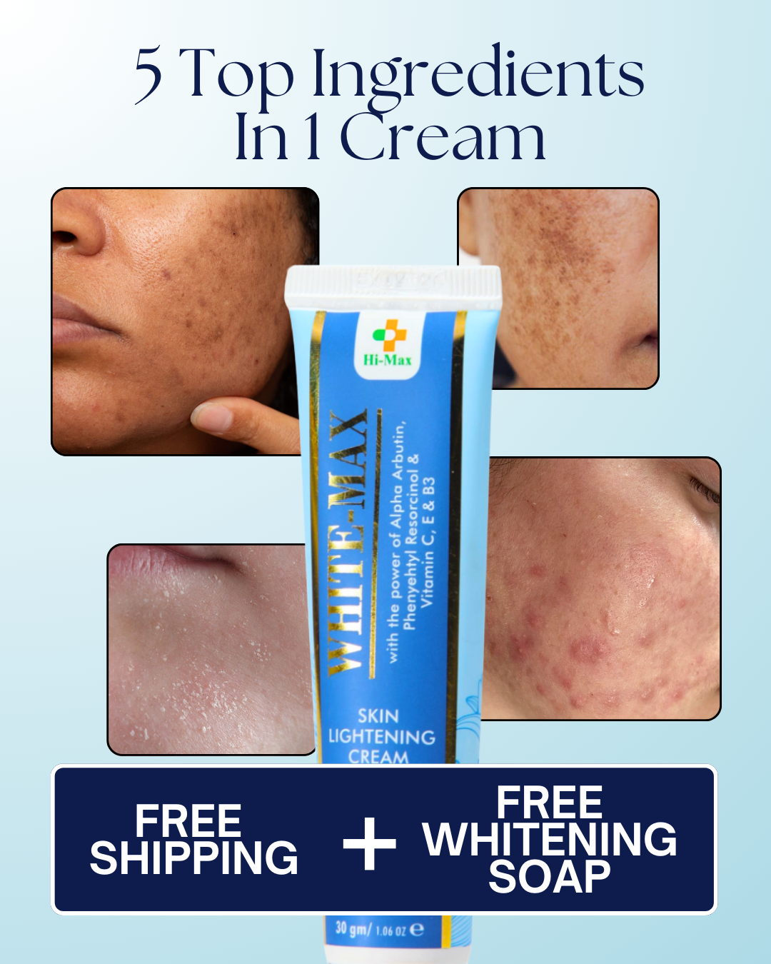 White Max - Whitening Cream